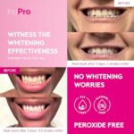 InoPro Teeth Whitening Strips 14 Treatments Kit – Teeth Whitener, Peroxide Free, Enamel Safe Green White Strips, Deep Stains Removal – Instant Teeth Whitening Without The Harm (28 Strips)